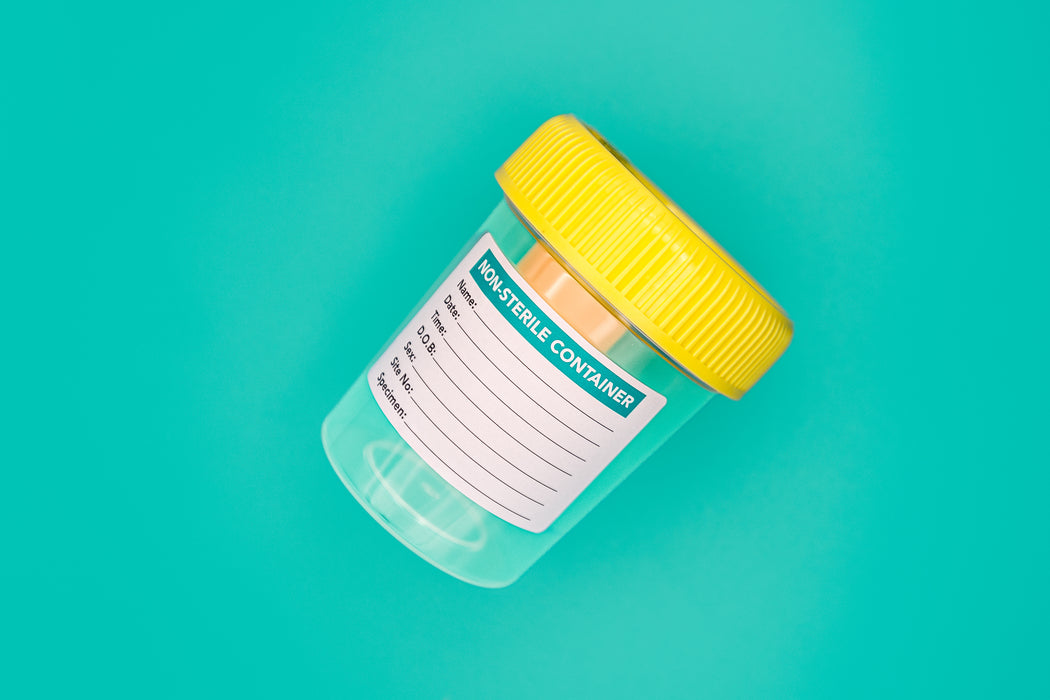 Urine Transfer Container 60mL Non-sterile