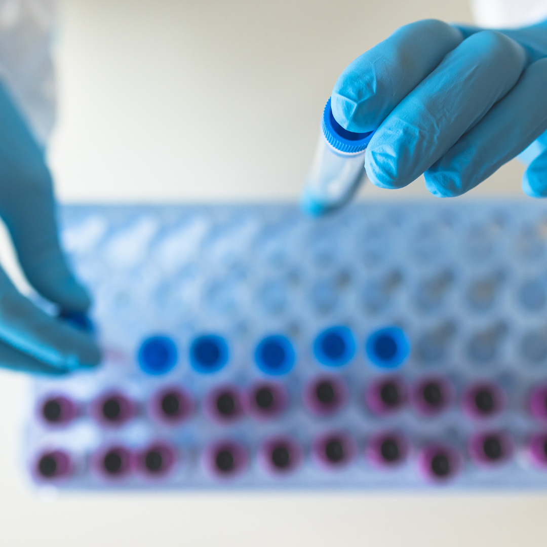 Correct Collection Proper Specimen Collection in Healthcare | Health Products Connect